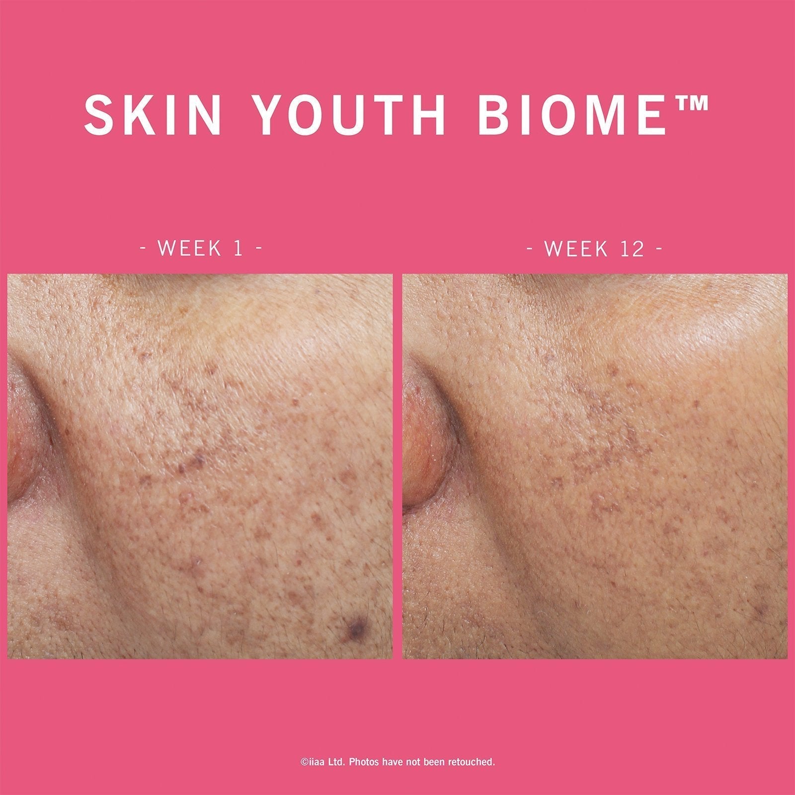 Advanced Nutrition Programme Advanced Nutrition Programme | Skin Youth Biome | 60 caps - SkinShop