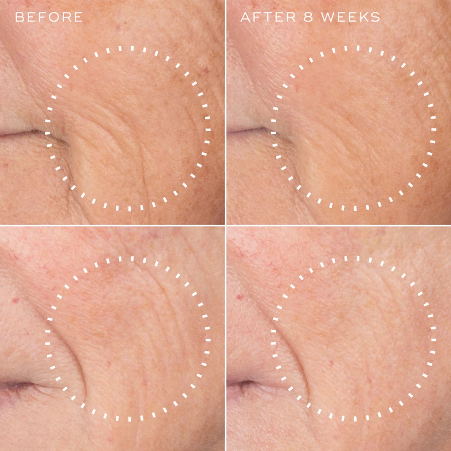 Close-up before and after skin showing smoother, softer wrinkles after 8 weeks of using Medik8 Liquid Peptides Advanced MP
