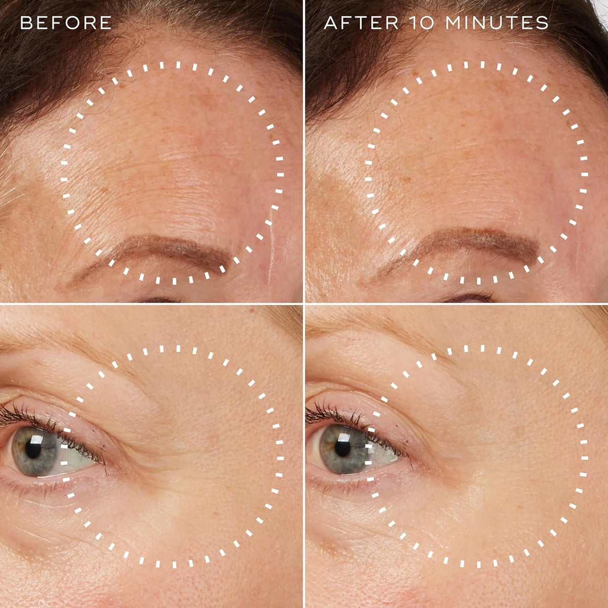 Before and after close-ups of forehead expression lines reduced 10 minutes after applying Medik8 Liquid Peptides Advanced MP