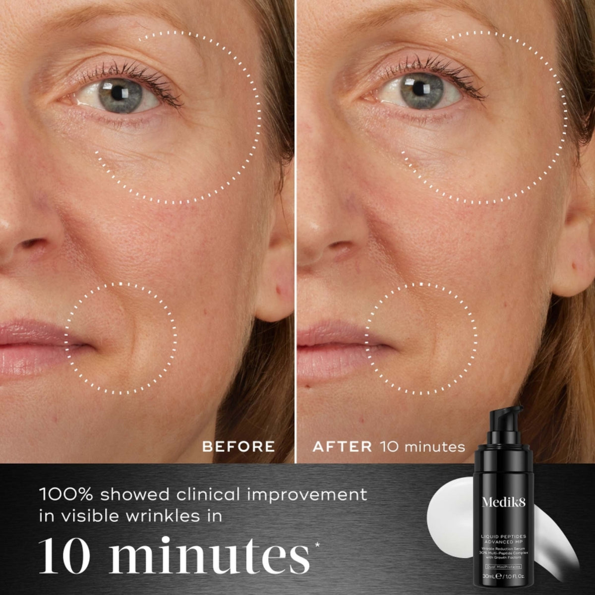 Before and after of a woman's face showing visibly reduced wrinkles 10 minutes after applying Medik8 Liquid Peptides Advanced MP