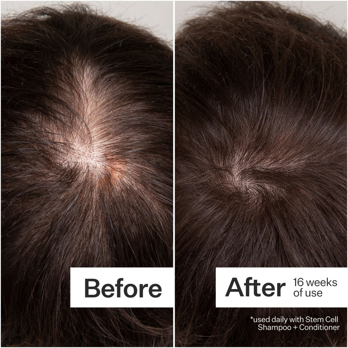 Act + AcreAct+Acre 3% Stem Cell Peptide Treatment 89mlSkinShop
