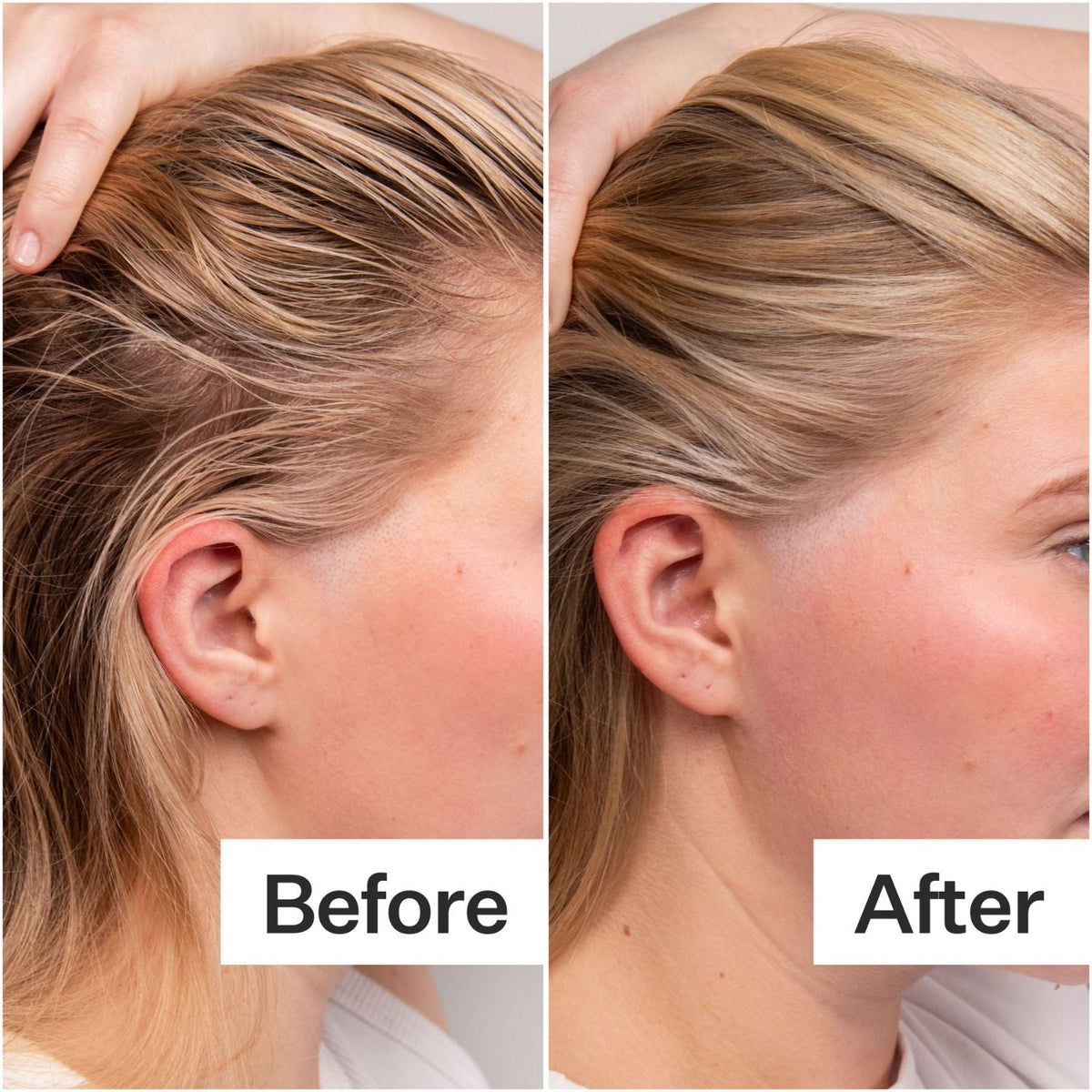 Act+Acre 4% Niacinamide Oily Scalp Serum SkinShop