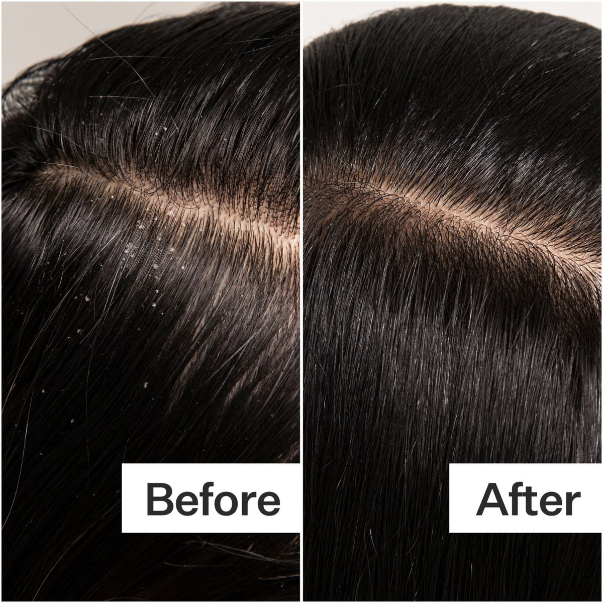 Act+Acre Cold Pressed Scalp Detox 89ml SkinShop