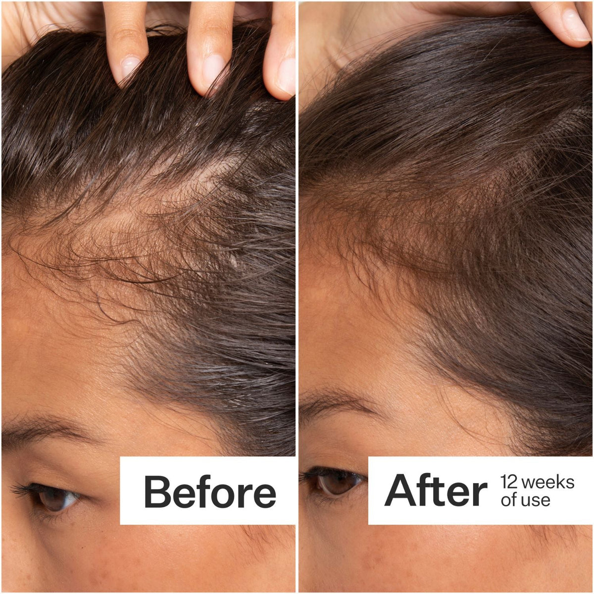 Act+Acre Stem Cell Scalp Serum 65ml SkinShop
