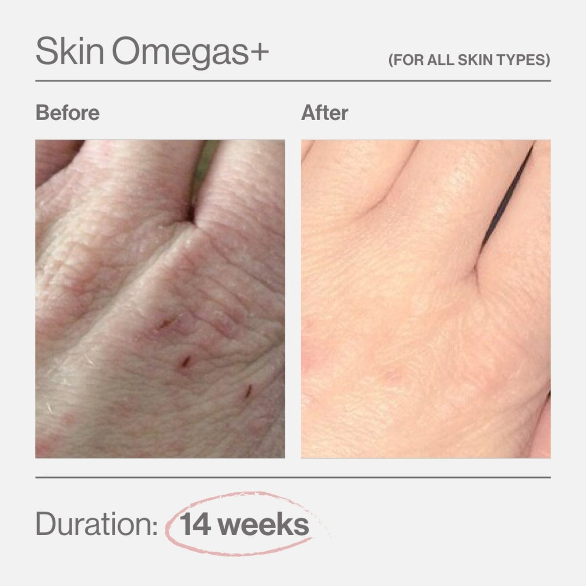 Advanced Nutrition ProgrammeAdvanced Nutrition Programme Skin Omegas+ 180 capsSkinShop