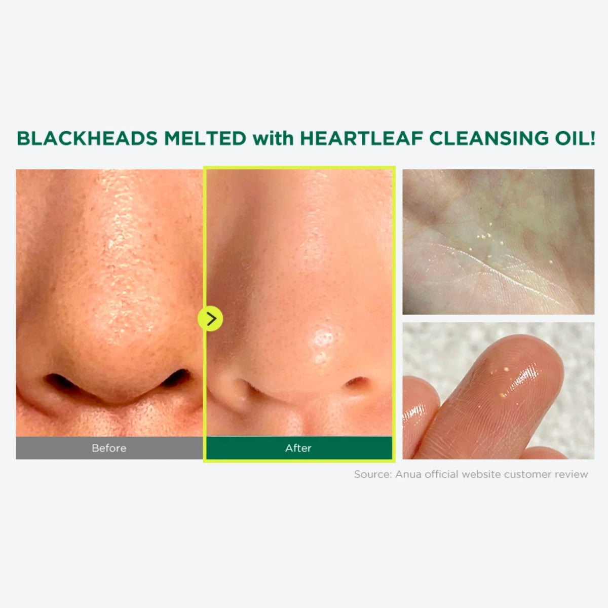 AnuaAnua Heartleaf Pore Control Cleansing Oil 200mlSkinShop