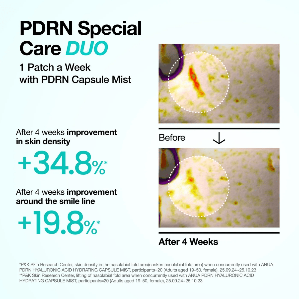 Anua PDRN Collagen Melting Patch for Glass Skin (4ea) SkinShop