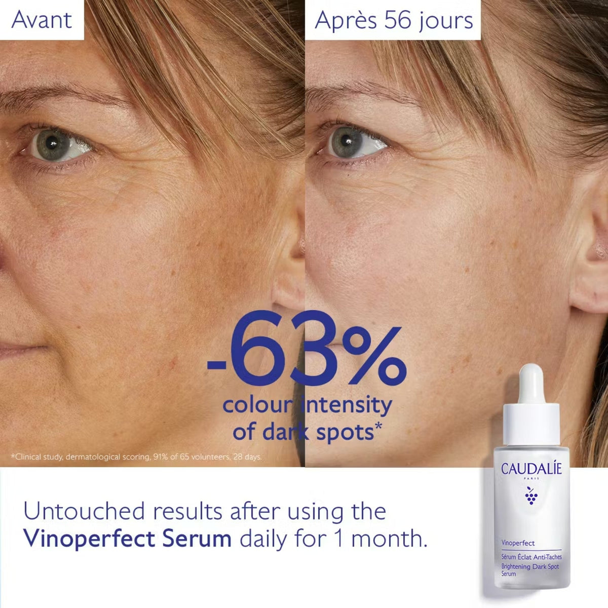 CaudalieCaudalie Vinoperfect Dark Spot Brightening Serum 50mlSkinShop