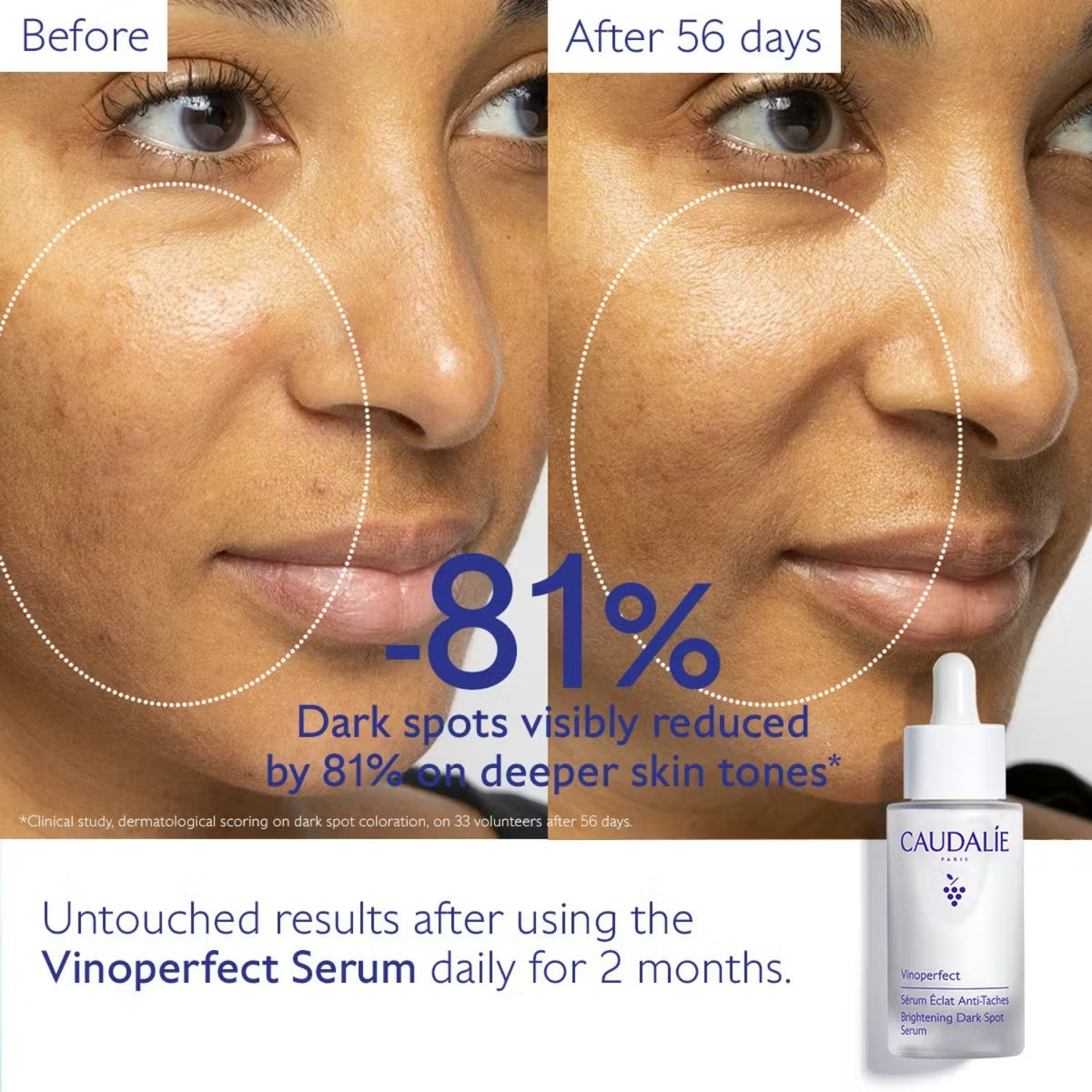 CaudalieCaudalie Vinoperfect Dark Spot Brightening Serum 50mlSkinShop