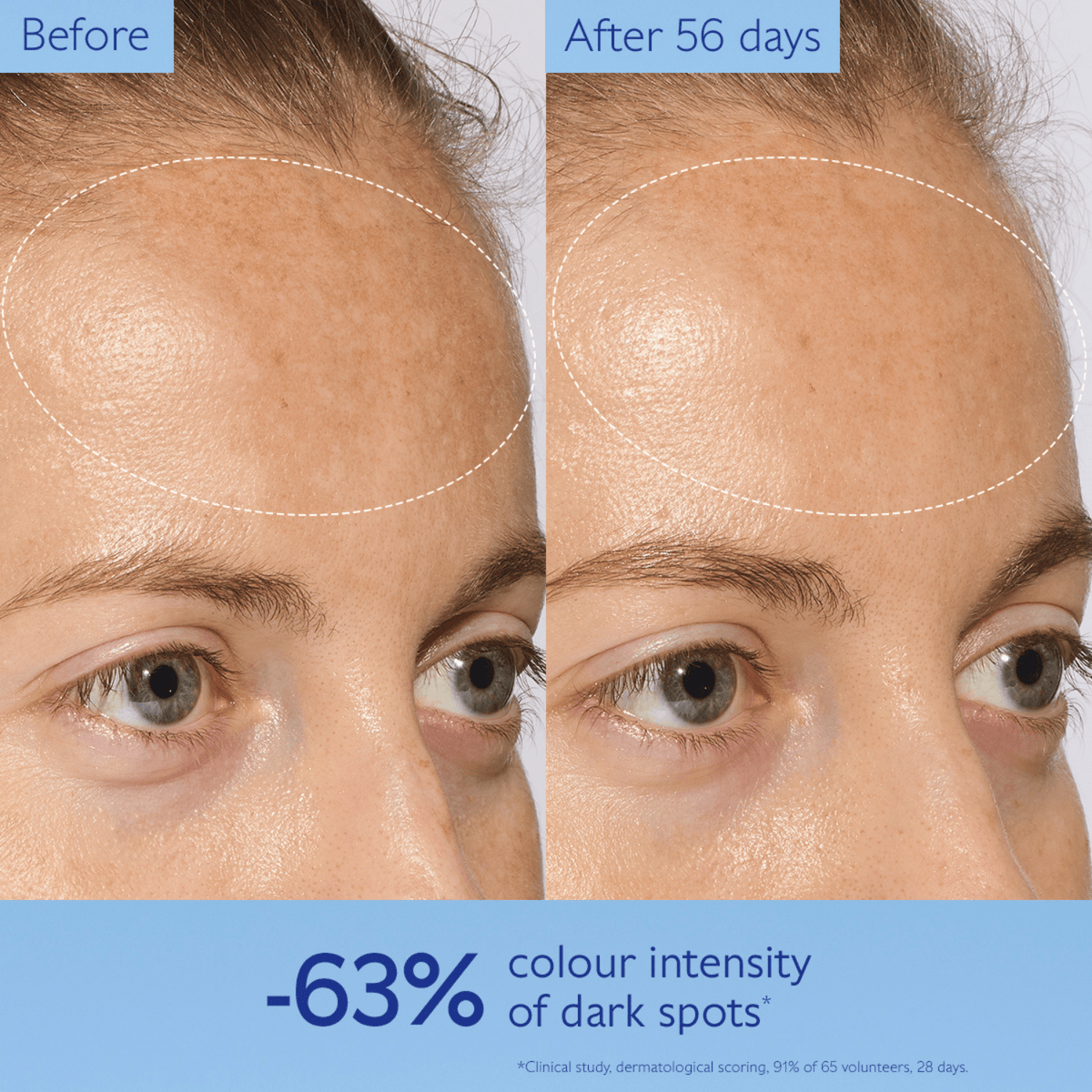 CaudalieCaudalie Vinoperfect Dark Spot Correcting DuoSkinShop