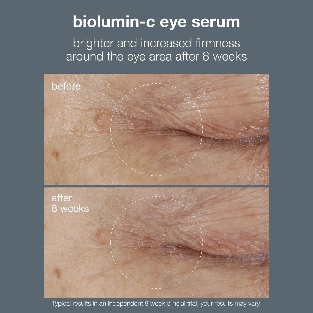 DermalogicaDermalogica Biolumin-C Vitamin C Eye Serum 15mlSkinShop