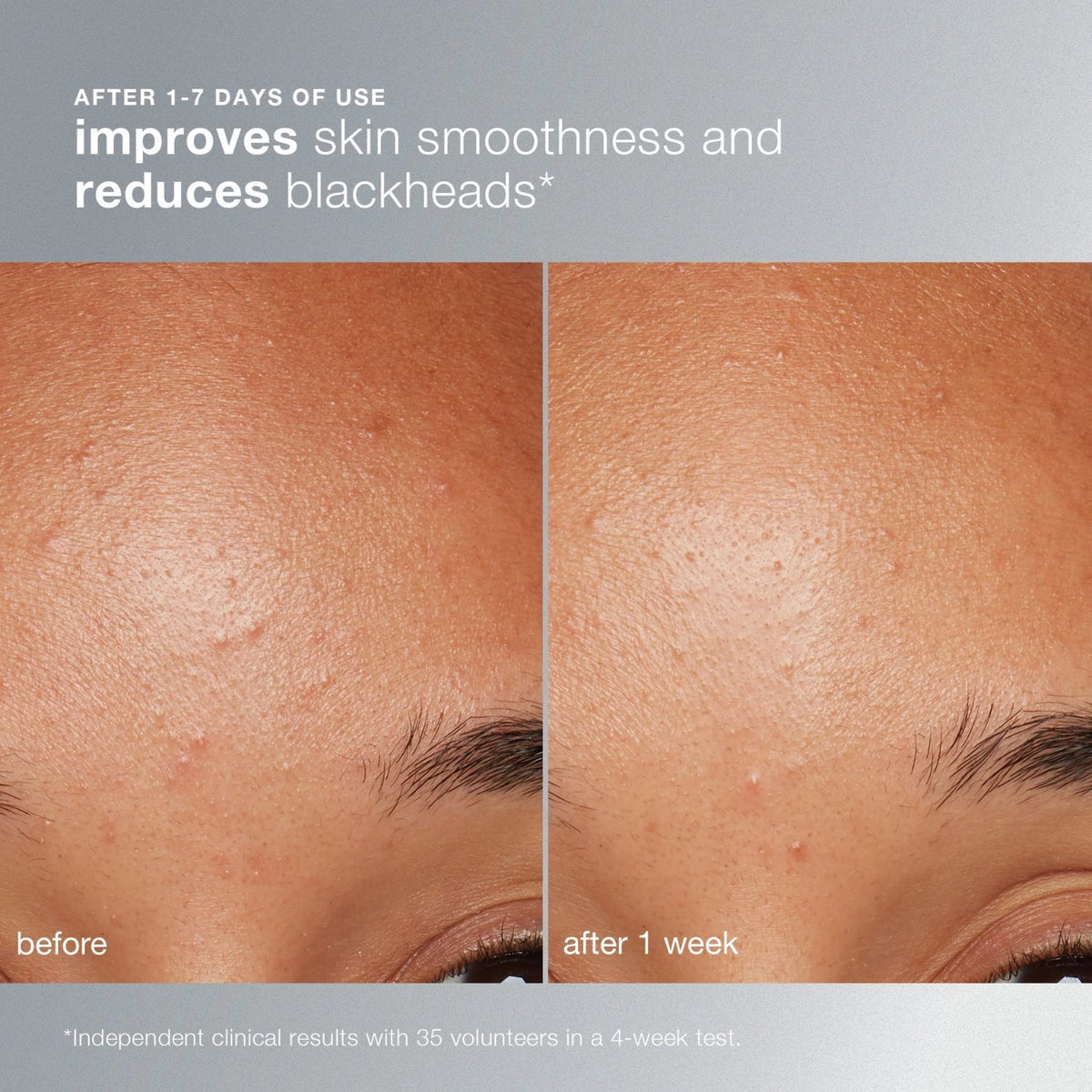 DermalogicaDermalogica Daily Microfoliant 74gSkinShop