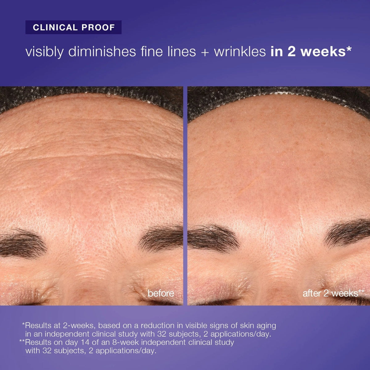 DermalogicaDermalogica Phyto Nature E² Regenerating Daily Exosome Leave-On TreatmentSkinShop