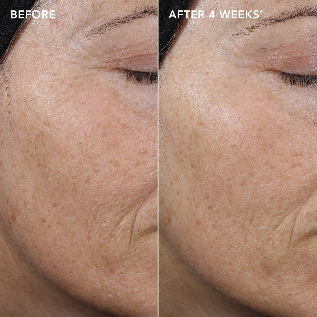 Image SkincareImage Skincare AGELESS+ Retinol Pure Liquid Retinol 0.3% 30mlSkinShop