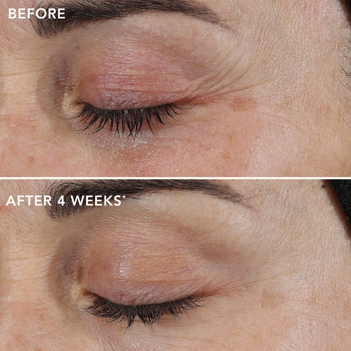 Image SkincareImage Skincare AGELESS+ Retinol Repair Cream 0.3% Retinol Complex 50mlSkinShop