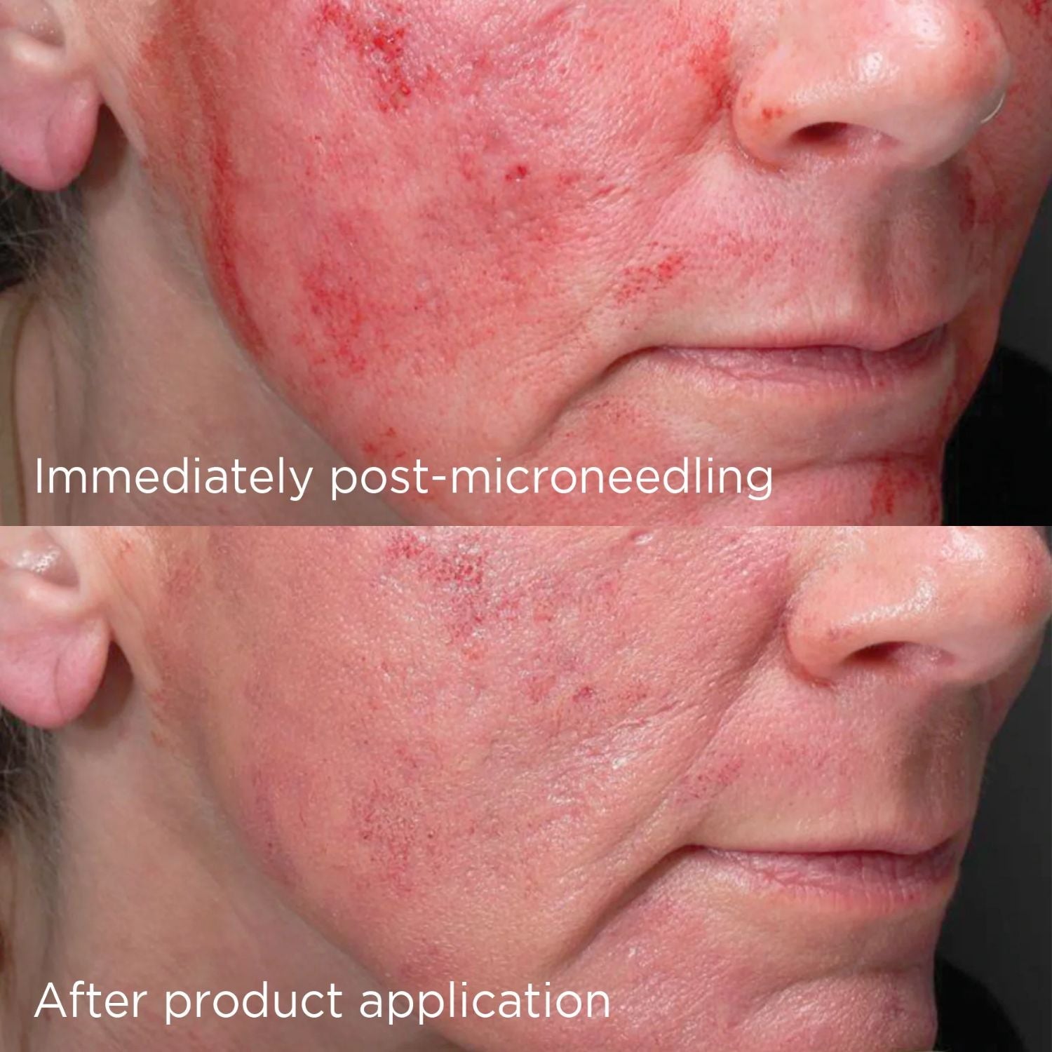 Image Skincare Image Skincare | Daily Prevention Advanced Smartblend Mineral Moisturizer SPF50+ 48ml - SkinShop