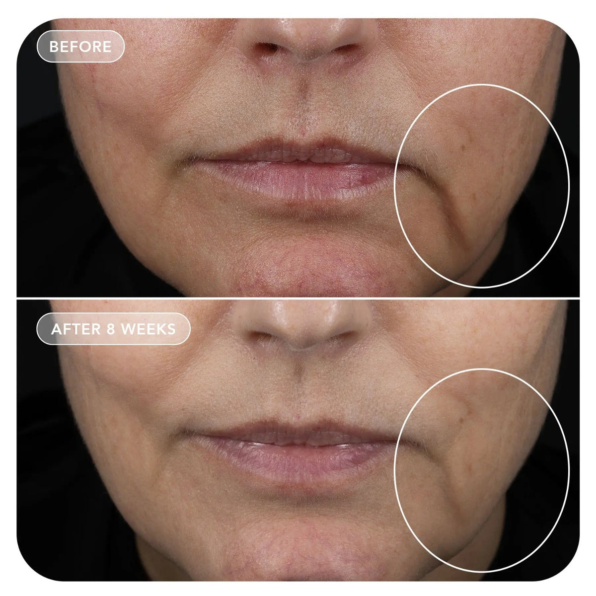 Image SkincareImage Skincare VOL.U.LIFT 4D Skin Rebound Complex 59mlSkinShop