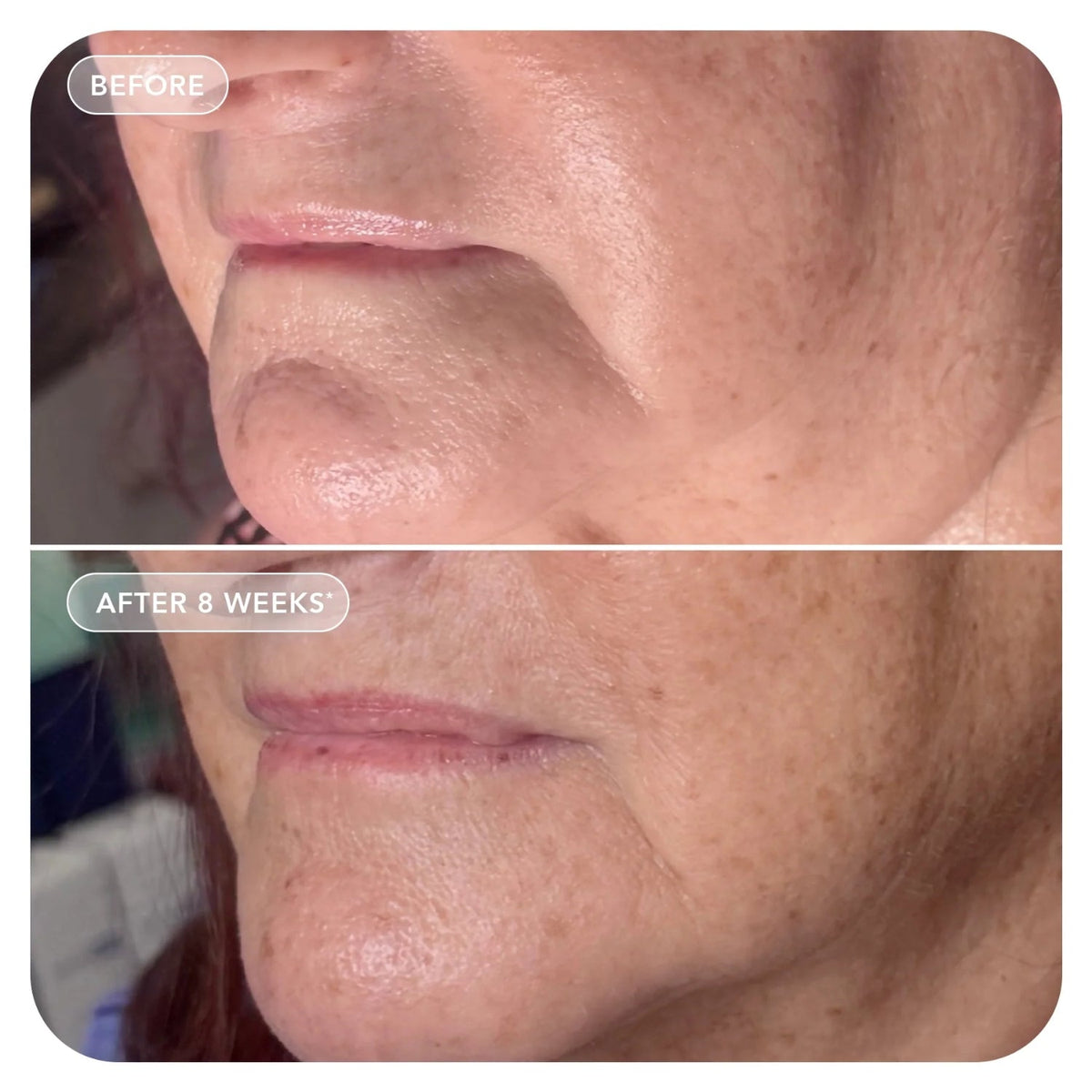 Image SkincareImage Skincare VOL.U.LIFT 4D Skin Rebound Complex 59mlSkinShop