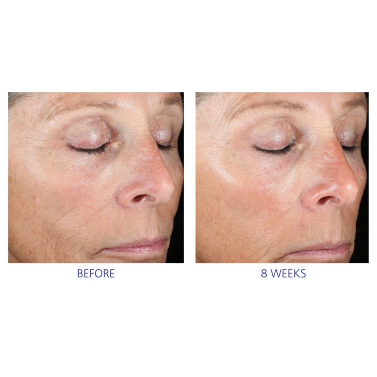 iS ClinicaliS Clinical Active Peel SystemSkinShop
