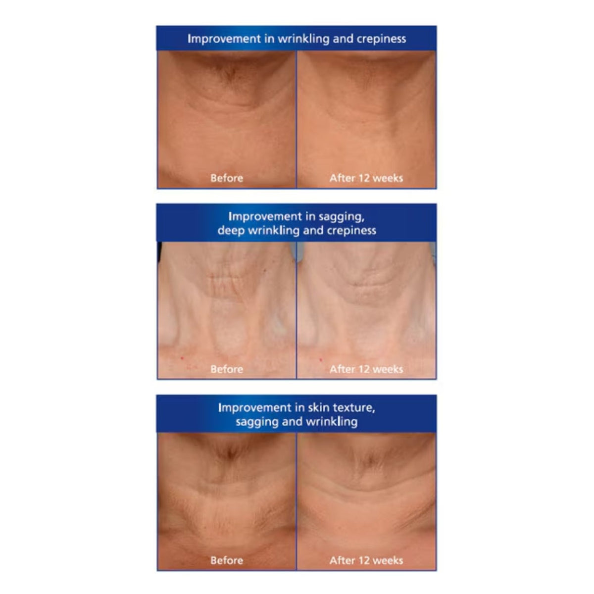 iS ClinicaliS Clinical Neck Perfect Complex 50gSkinShop