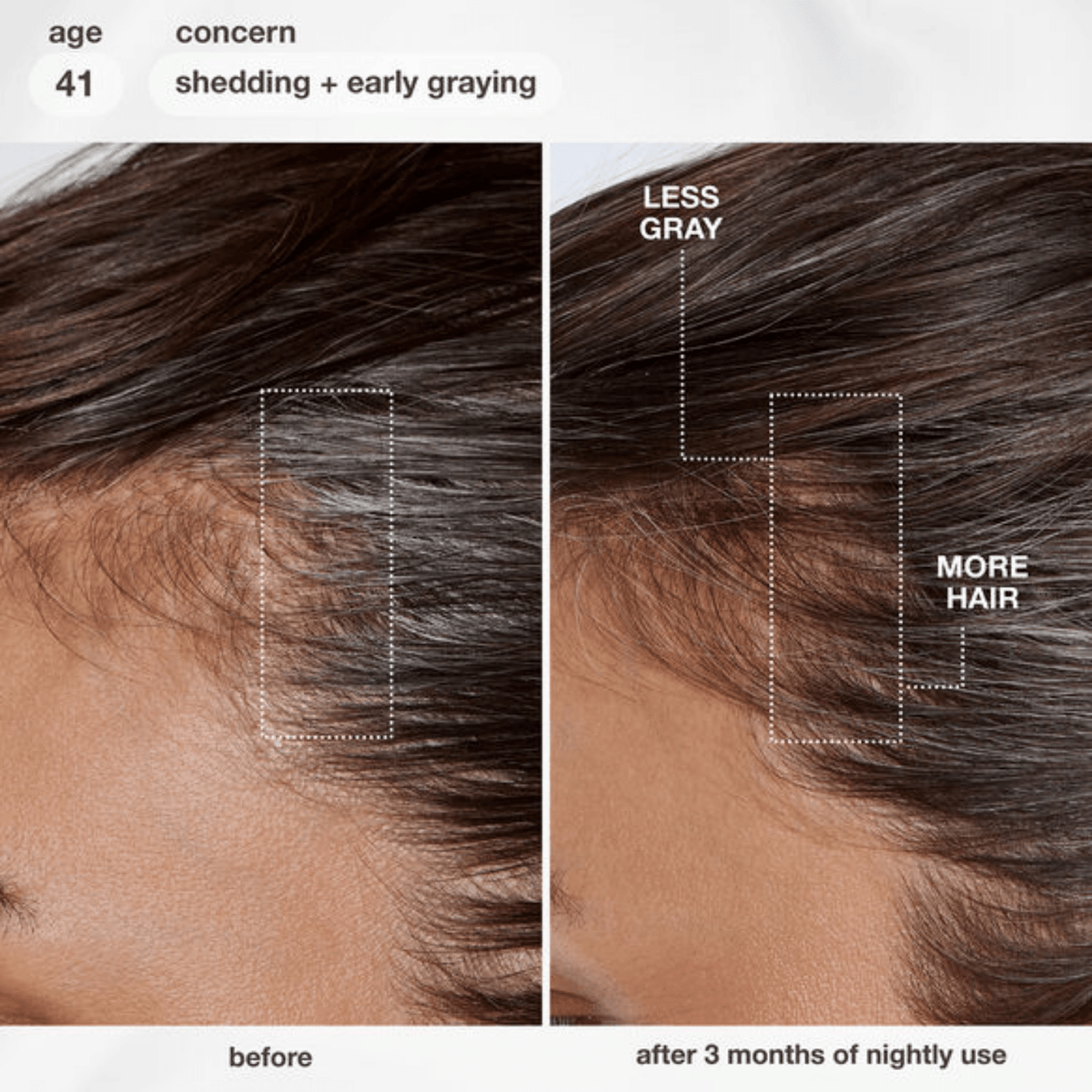 K18K18 FutureIQ™ Biomimetic Hair Longevity Serum 90mlSkinShop