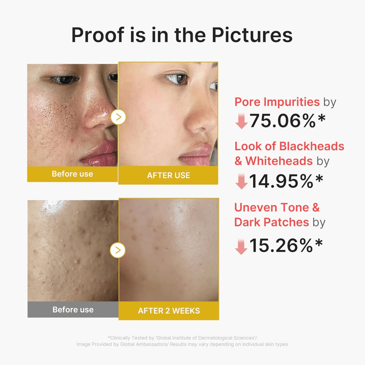 MedicubeMedicube Kojic Acid Turmeric Peel Shot 80mlSkinShop