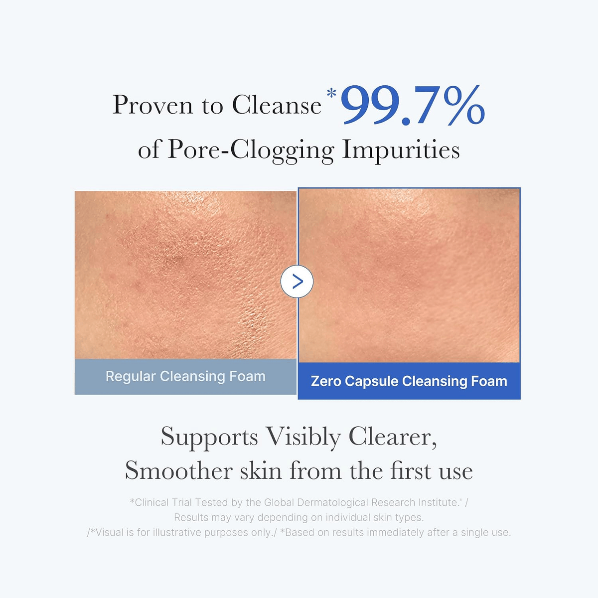 MedicubeMedicube Zero Pore Clearing Capsule Cleansing FoamSkinShop