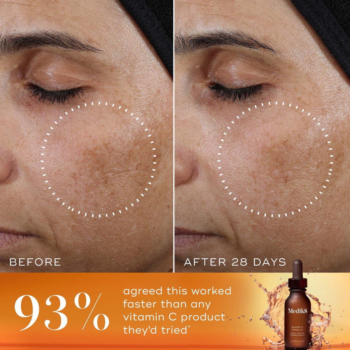 Medik8Medik8 Super C Ferulic 30mlSkinShop