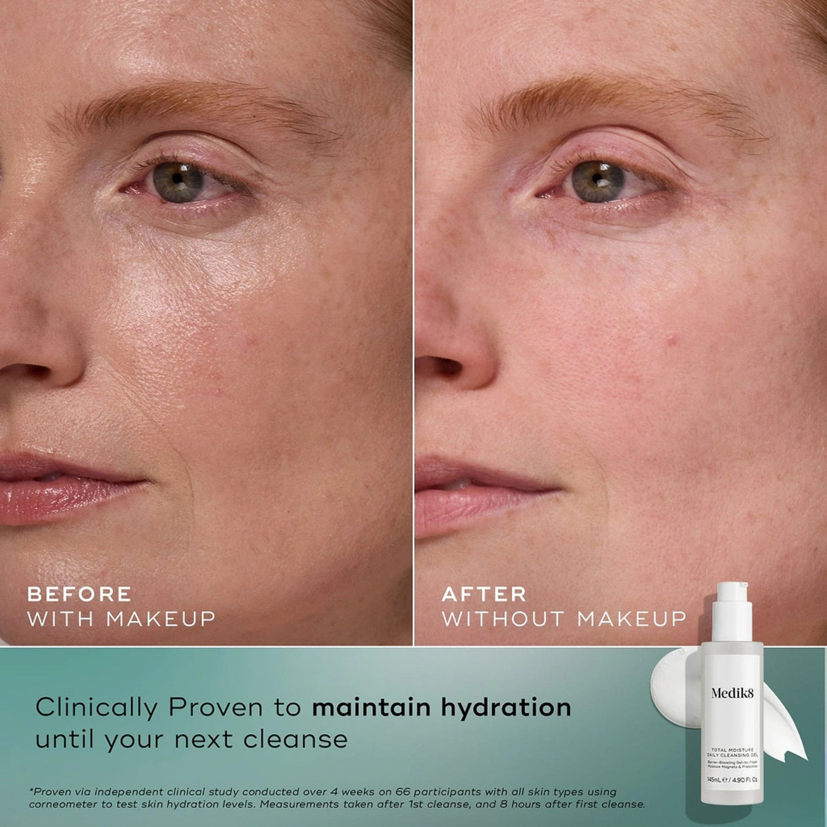 Medik8Medik8 Total Moisture Daily Cleansing Gel 145mlSkinShop