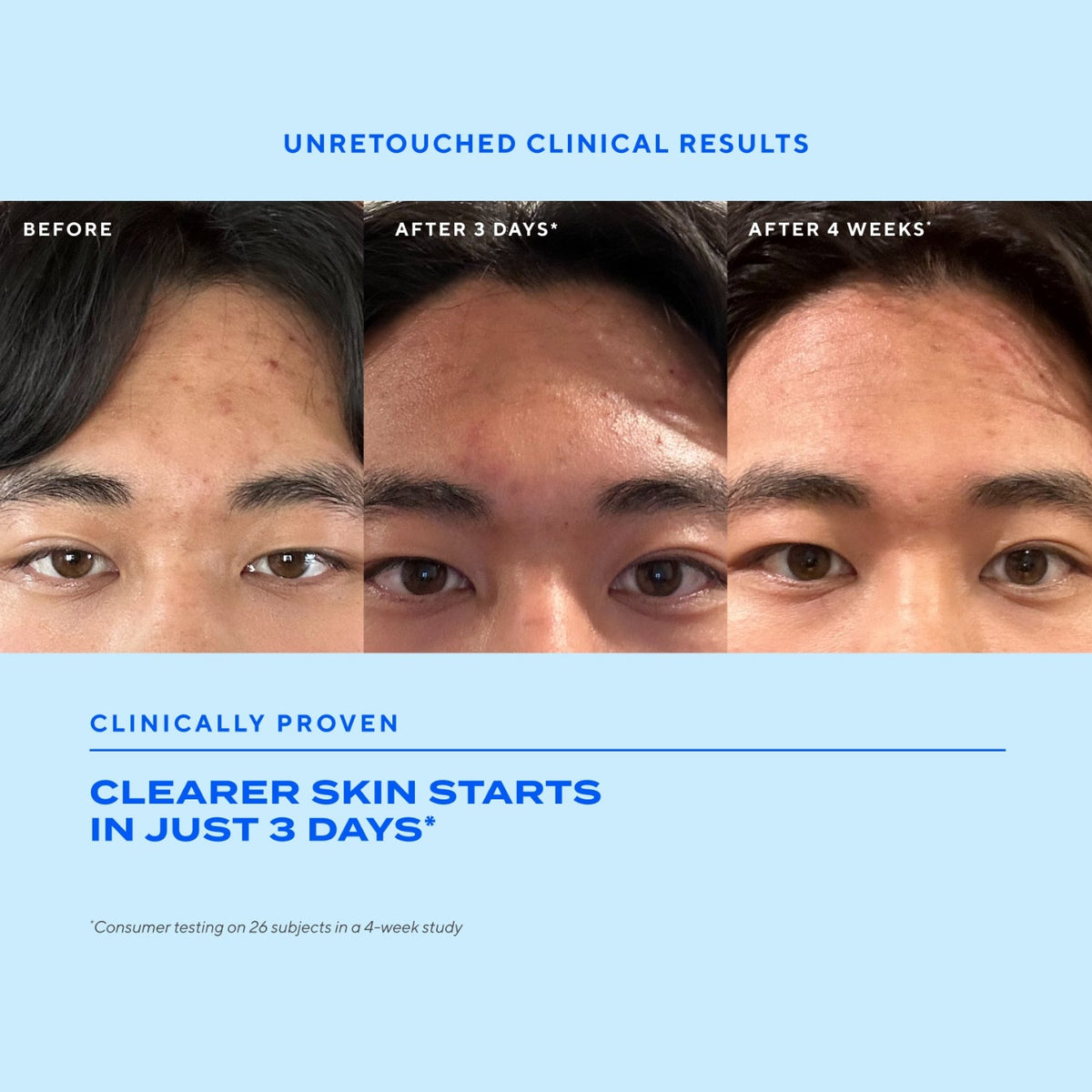 MuradMurad Biome-Balancing Clear & Prevent Blemish Treatment Serum 30mlSkinShop