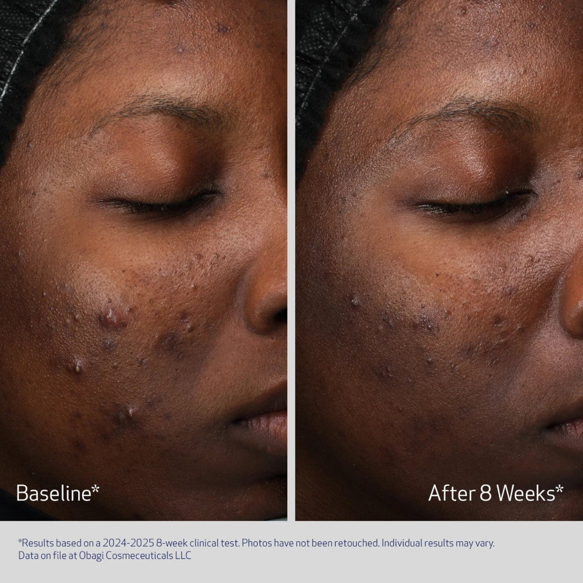 ObagiObagi Retinol + PHA Refining Night Cream 50mlSkinShop