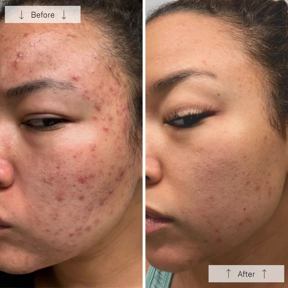OmniluxOmnilux Clear Face MaskSkinShop
