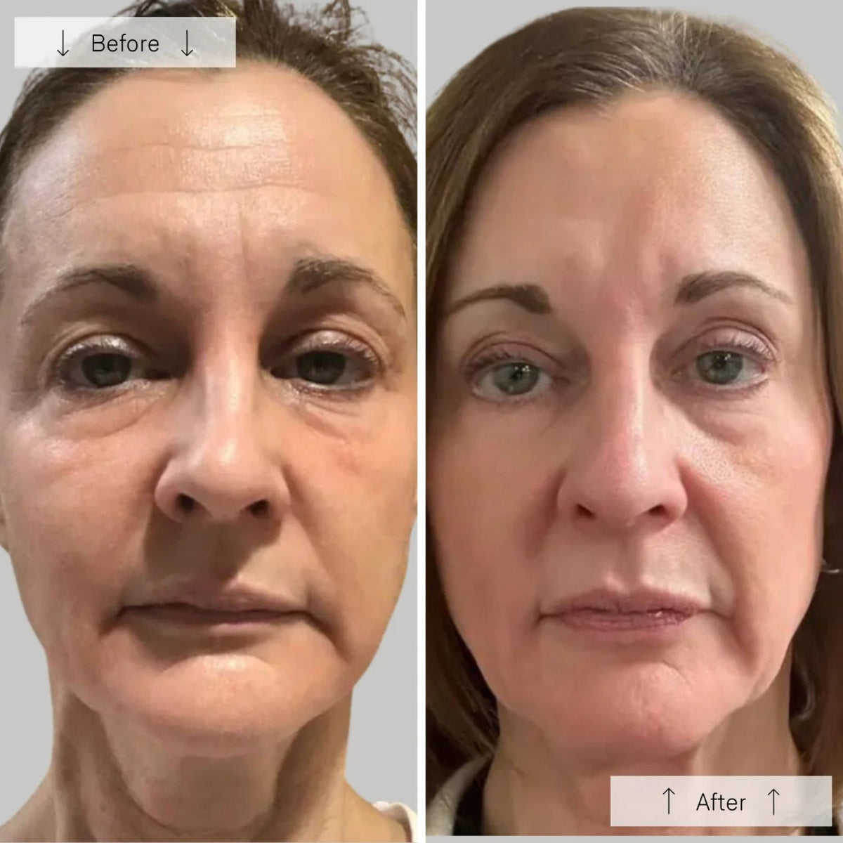 OmniluxOmnilux Contour Face MaskSkinShop