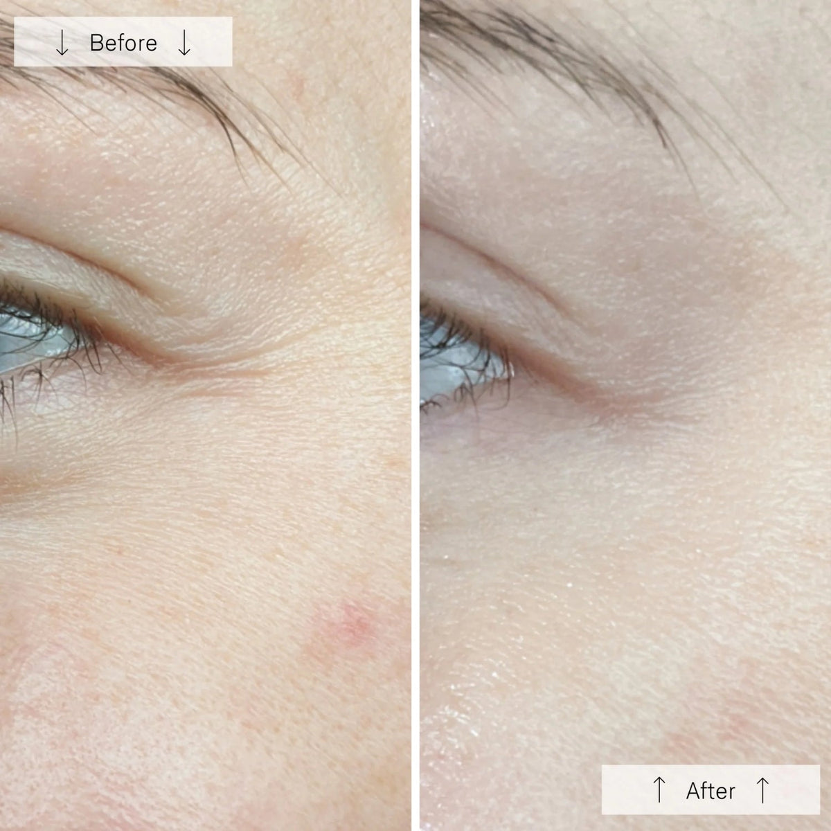 OmniluxOmnilux Contour Face MaskSkinShop