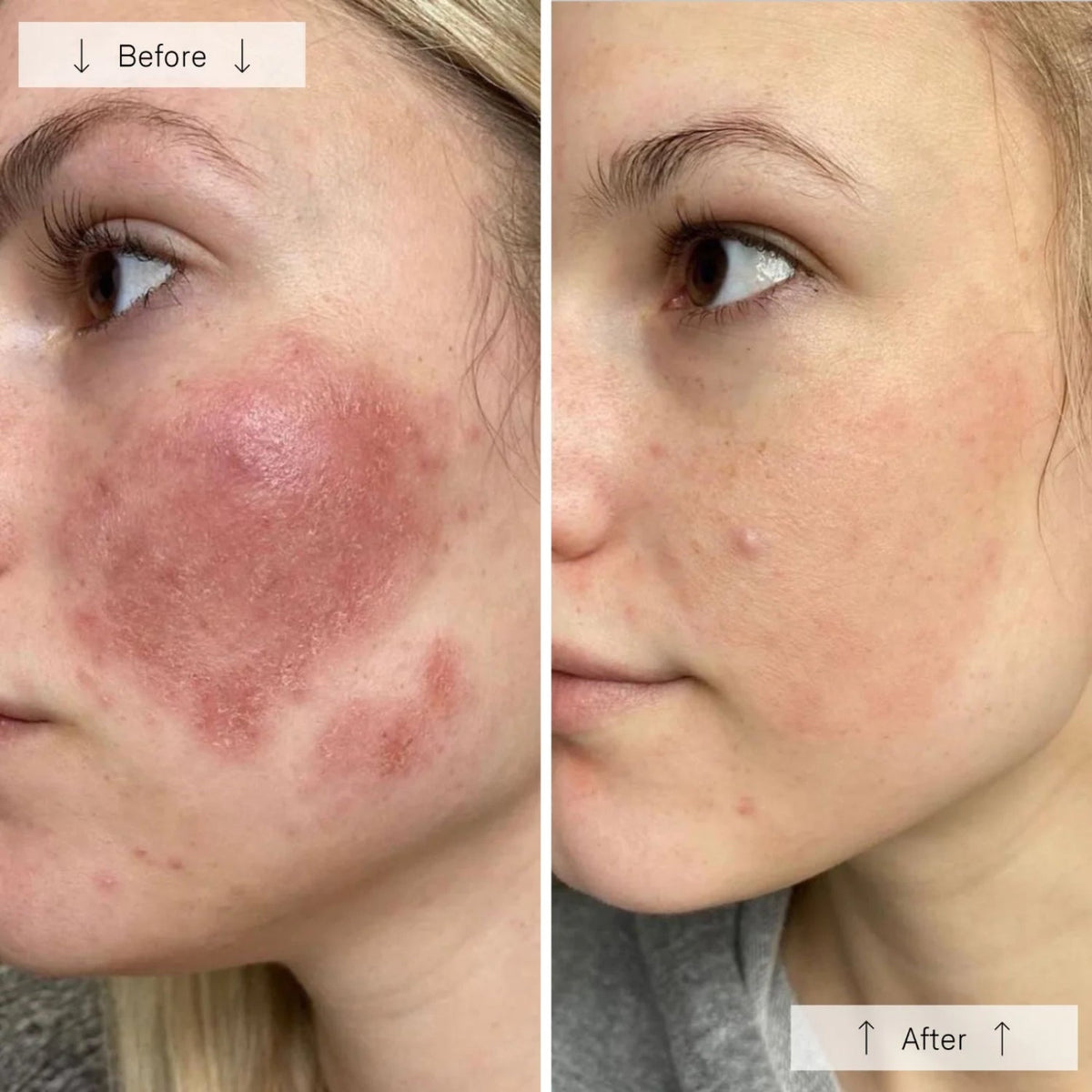 OmniluxOmnilux Contour Face MaskSkinShop