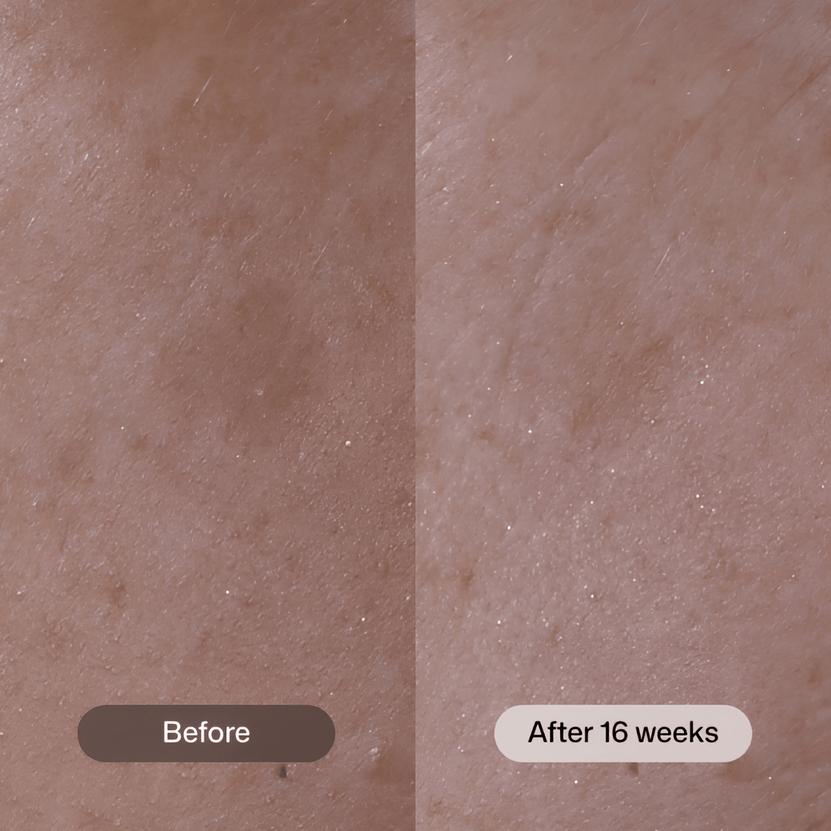 Revision SkincareRevision Skincare Advanced Pigment Corrector+ 30gSkinShop