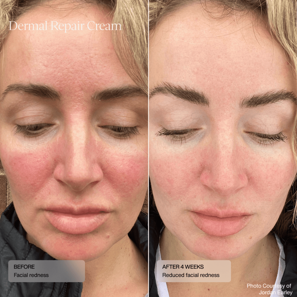 SentéSenté Dermal Repair Cream 50mlSkinShop