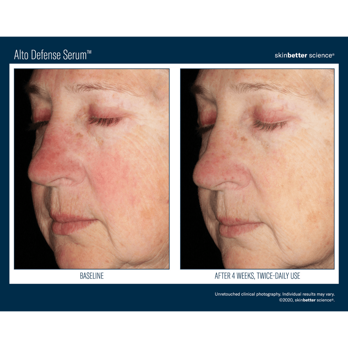 Skinbetter ScienceSkinbetter Science Alto Defense Serum 30mlSkinShop