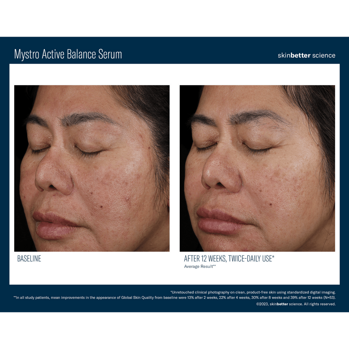 Skinbetter ScienceSkinbetter Science Mystro Active Balance Serum 15mlSkinShop
