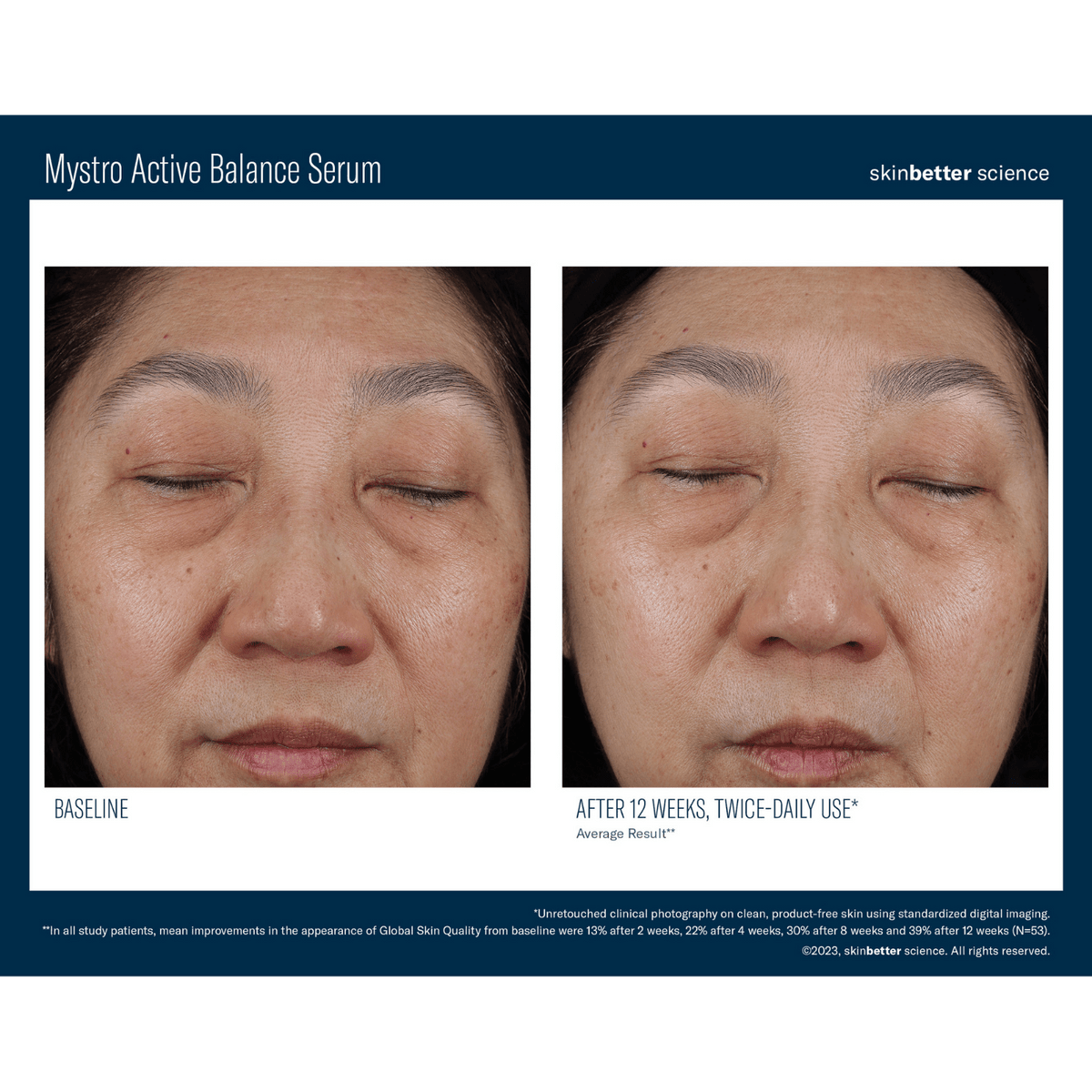 Skinbetter ScienceSkinbetter Science Mystro Active Balance Serum 15mlSkinShop