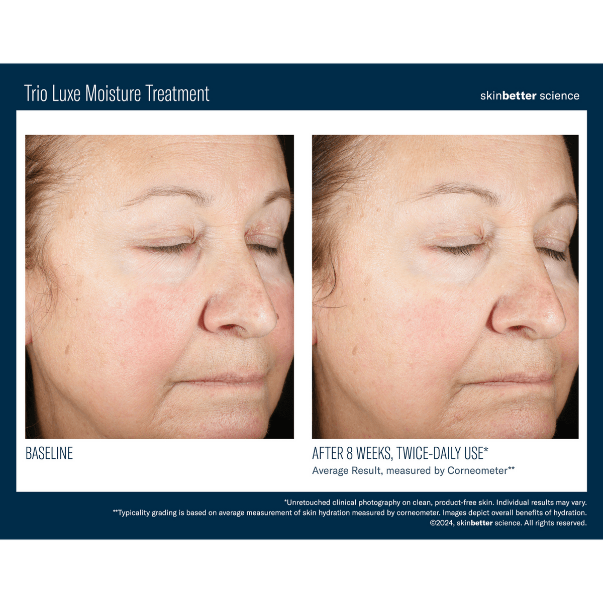 Skinbetter ScienceSkinbetter Science Trio Luxe Moisture Treatment 50mlSkinShop