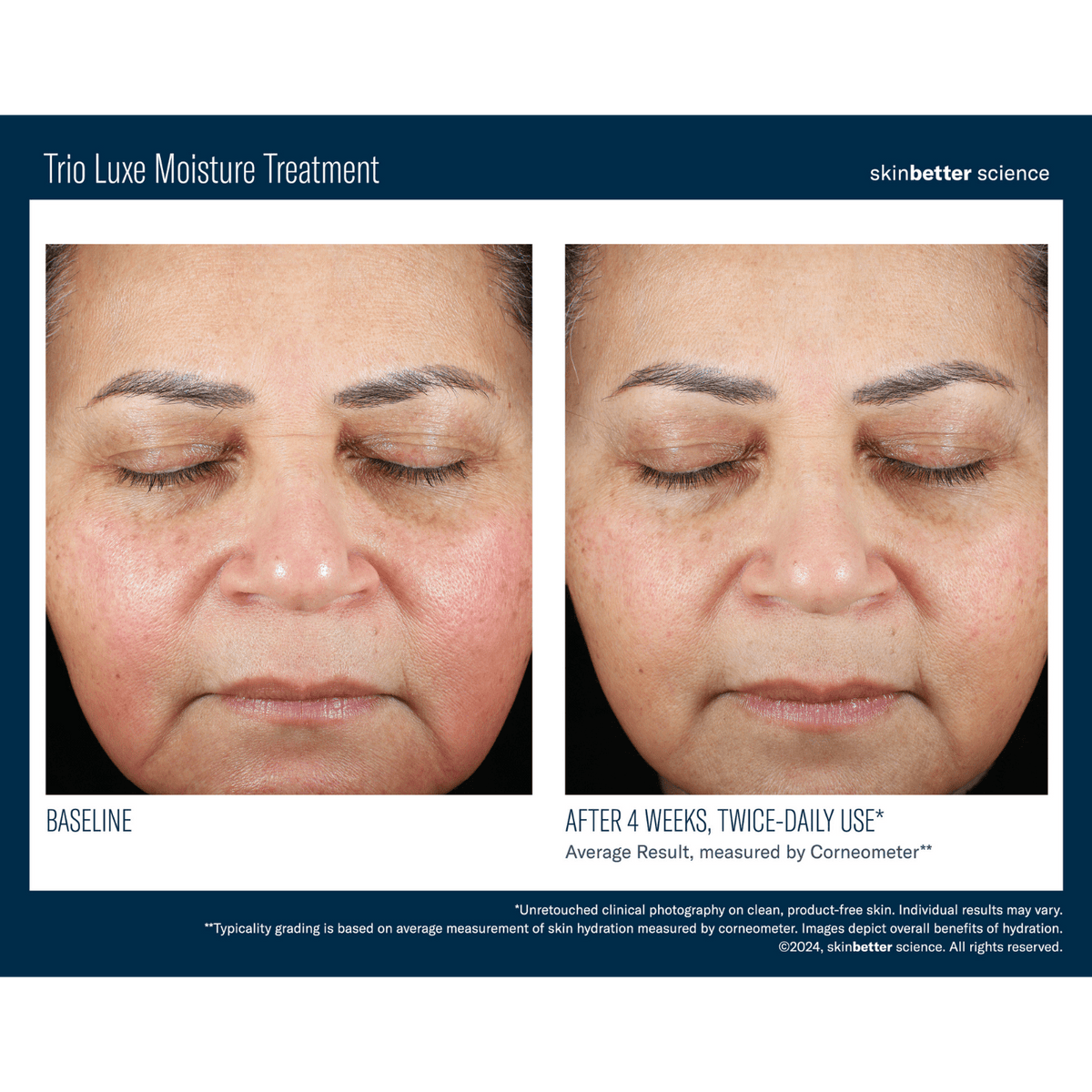 Skinbetter ScienceSkinbetter Science Trio Luxe Moisture Treatment 50mlSkinShop