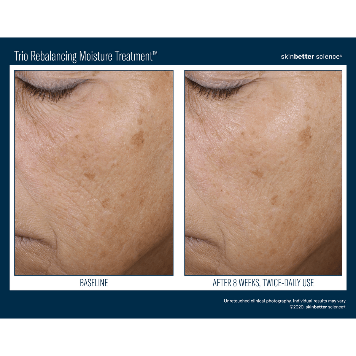 Skinbetter ScienceSkinbetter Science Trio Rebalancing Moisture Treatment 50mlSkinShop