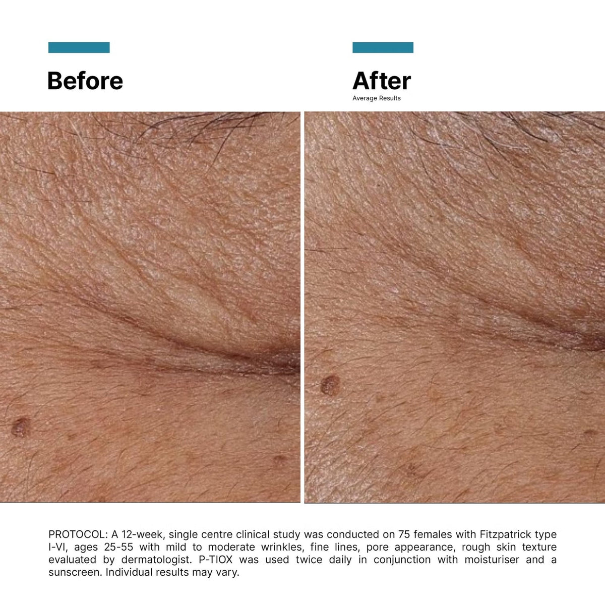 SkinCeuticalsSkinCeuticals P-Tiox 30mlSkinShop