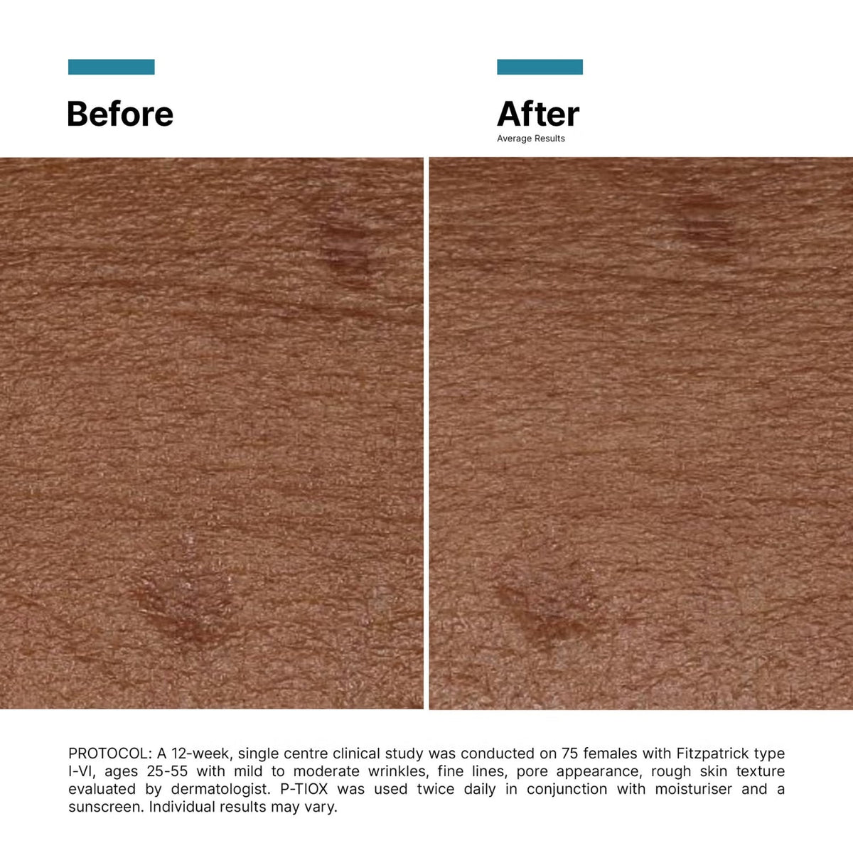 SkinCeuticalsSkinCeuticals P-Tiox 30mlSkinShop