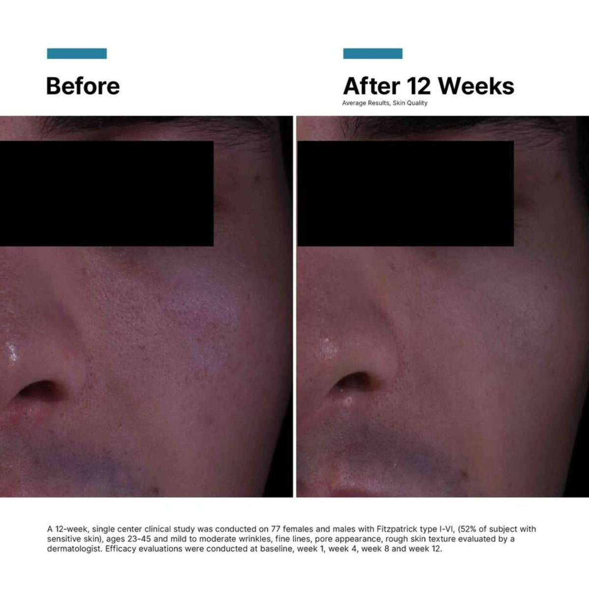 SkinCeuticalsSkinCeuticals P-TIOX Anti-Wrinkle Cream 48mlSkinShop