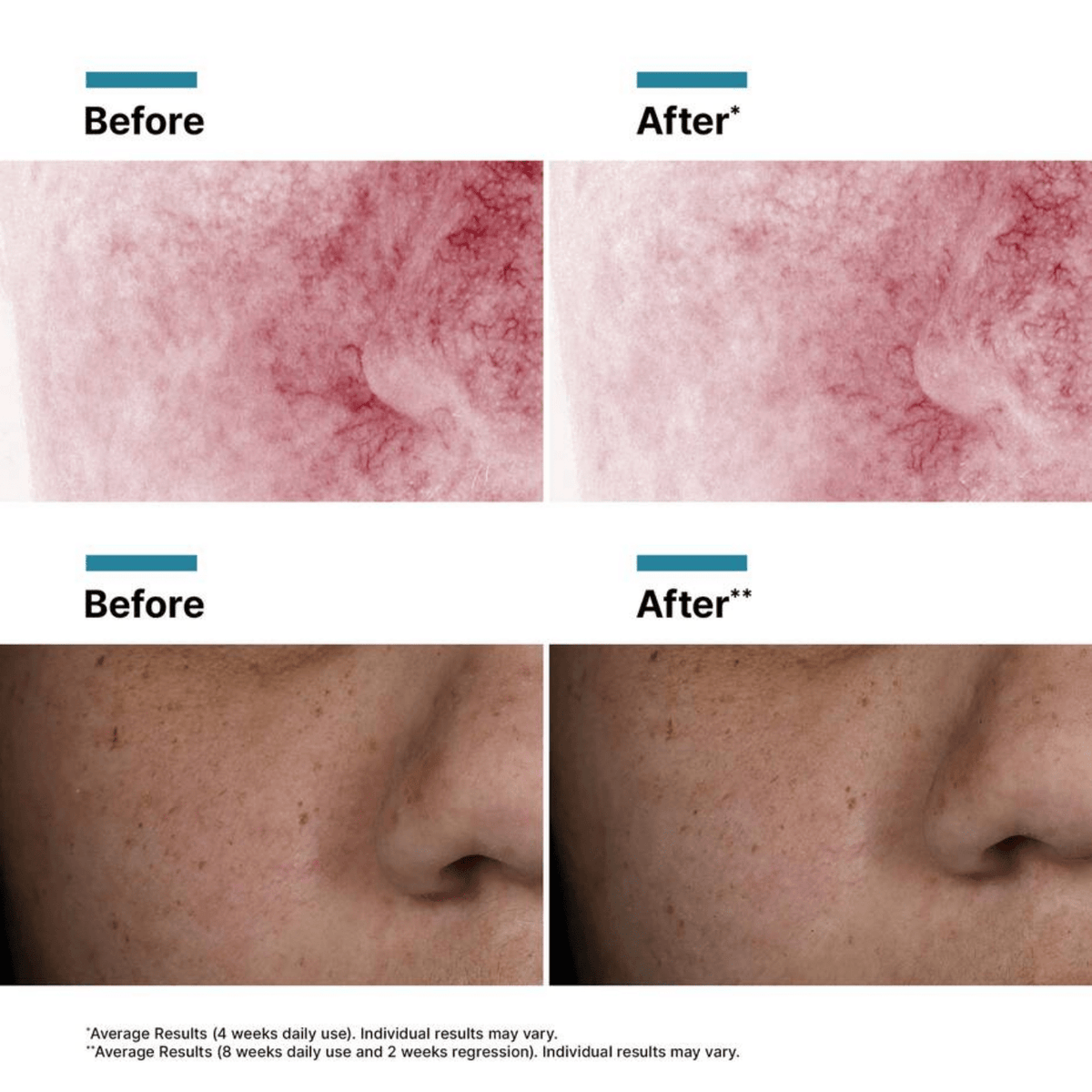 SkinCeuticalsSkinCeuticals Phyto Corrective with PDRN from Biotech Serum 30mlSkinShop