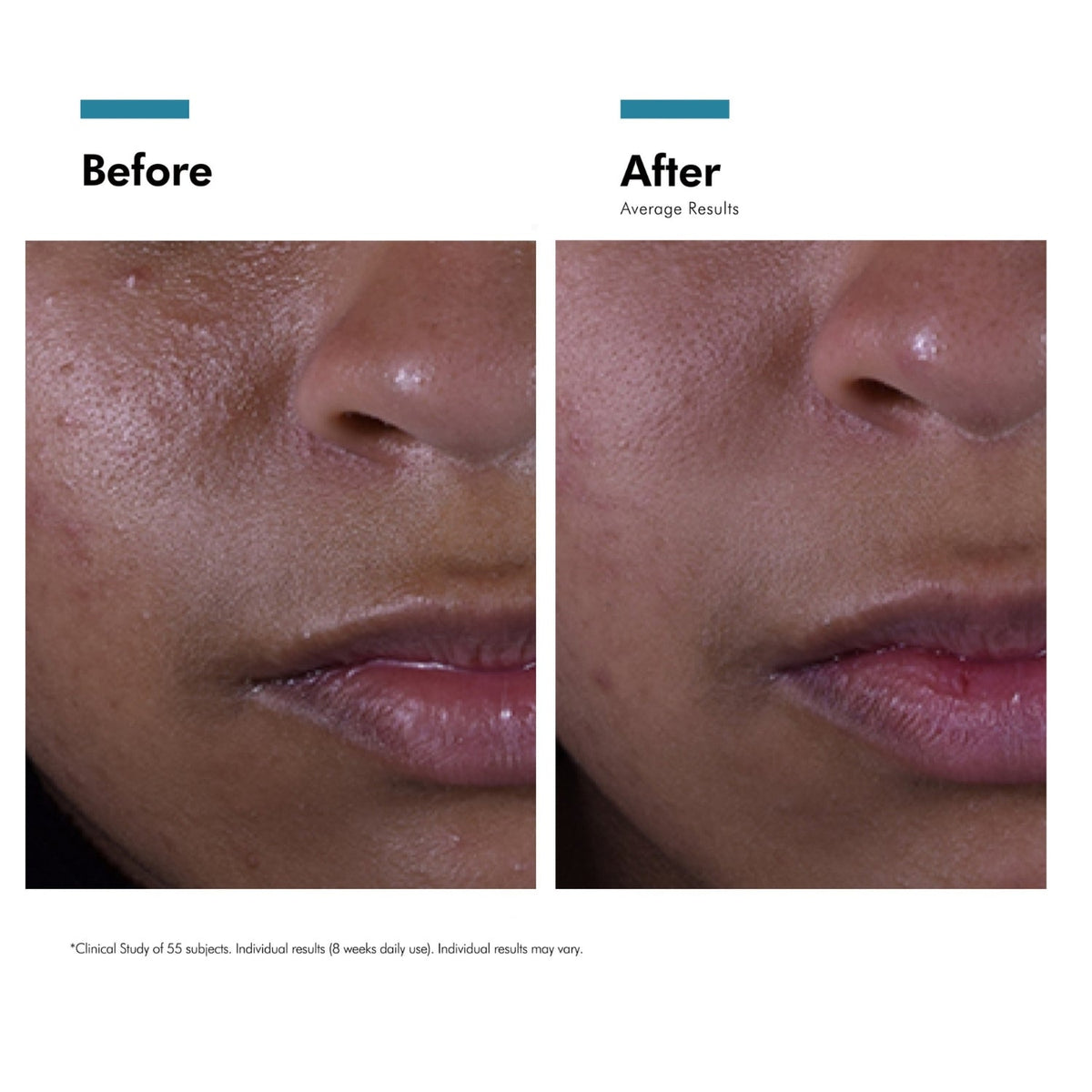 SkinCeuticalsSkinCeuticals Silymarin CF 30mlSkinShop