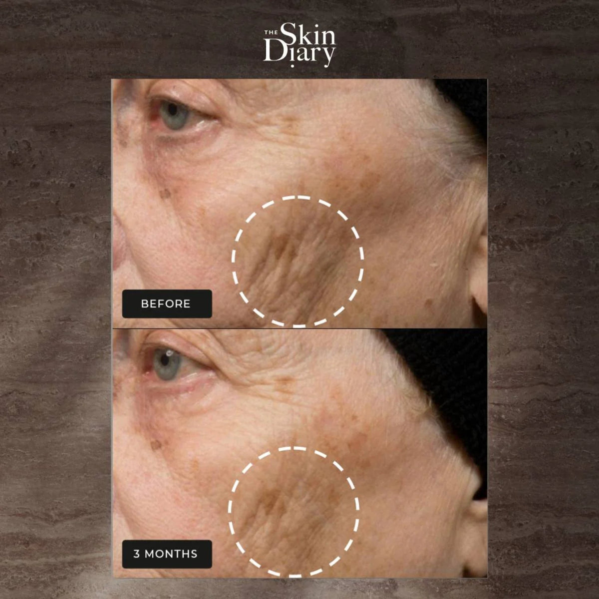 The Skin DiaryThe Skin Diary Night Repair Therapy 50mlSkinShop