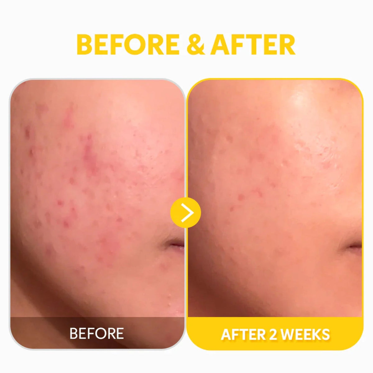 TIRTIRTIRTIR Pure Vitamin C24 Serum 30mlSkinShop